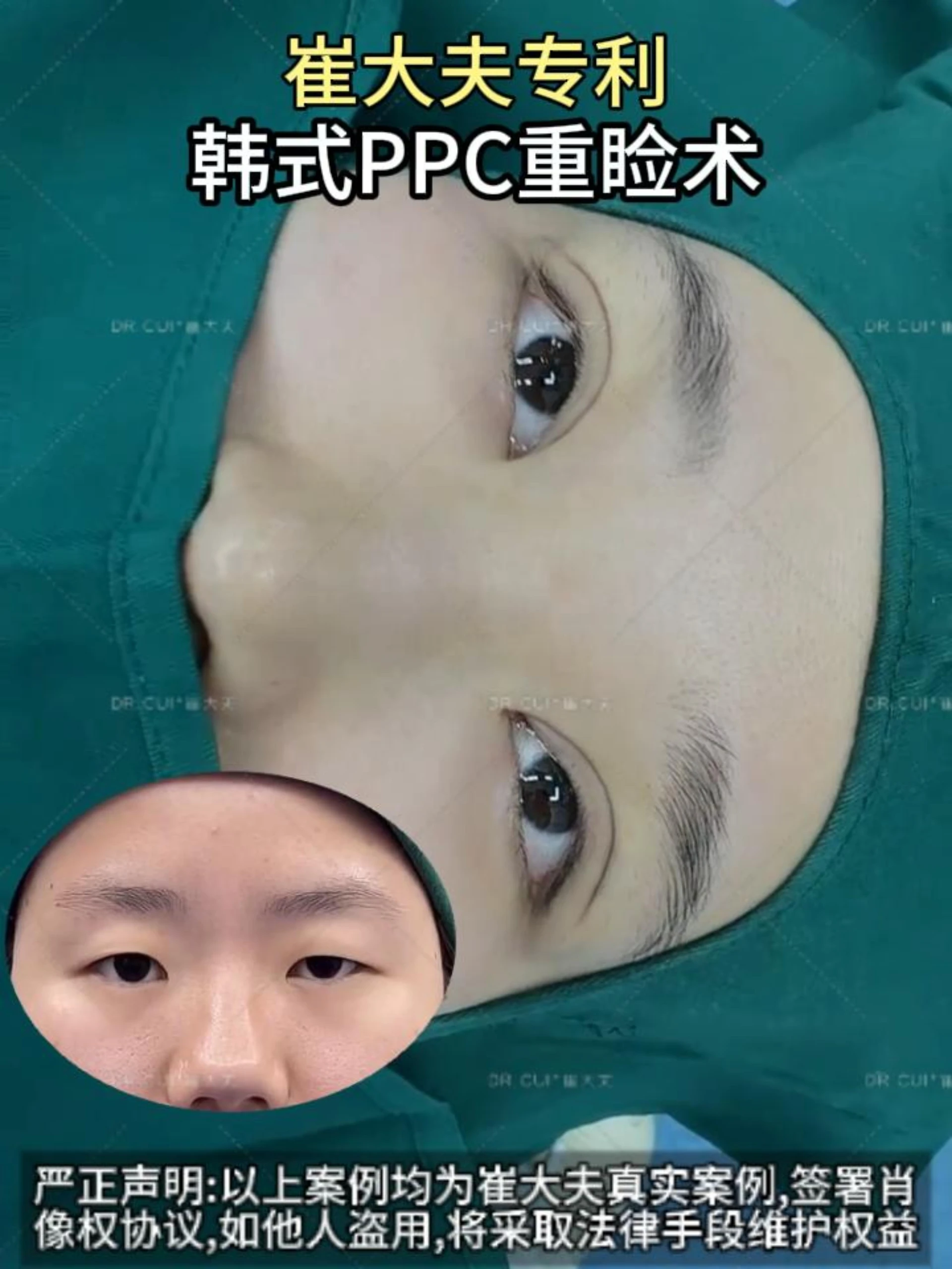 对比 (111)