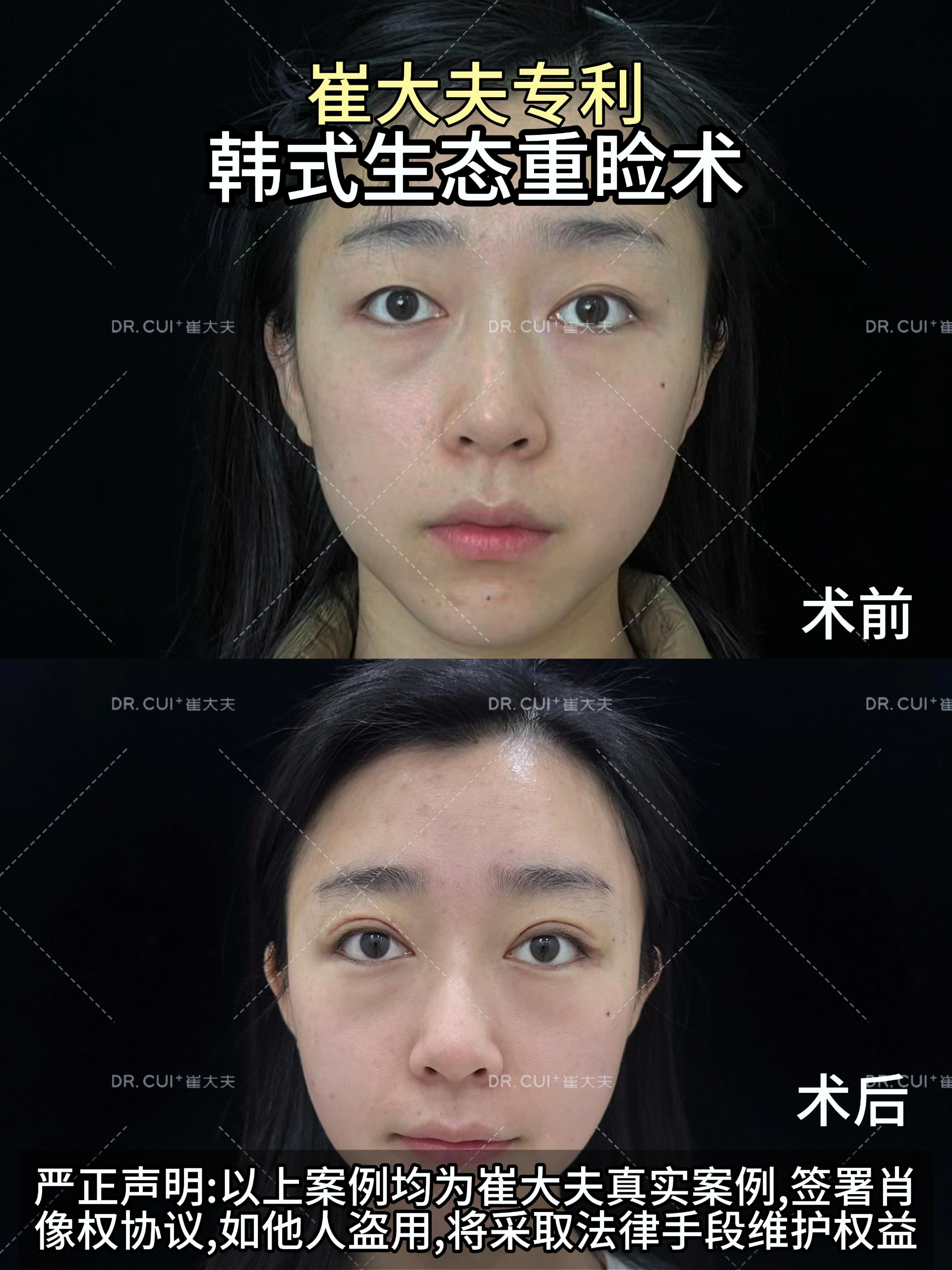 对比 (112)