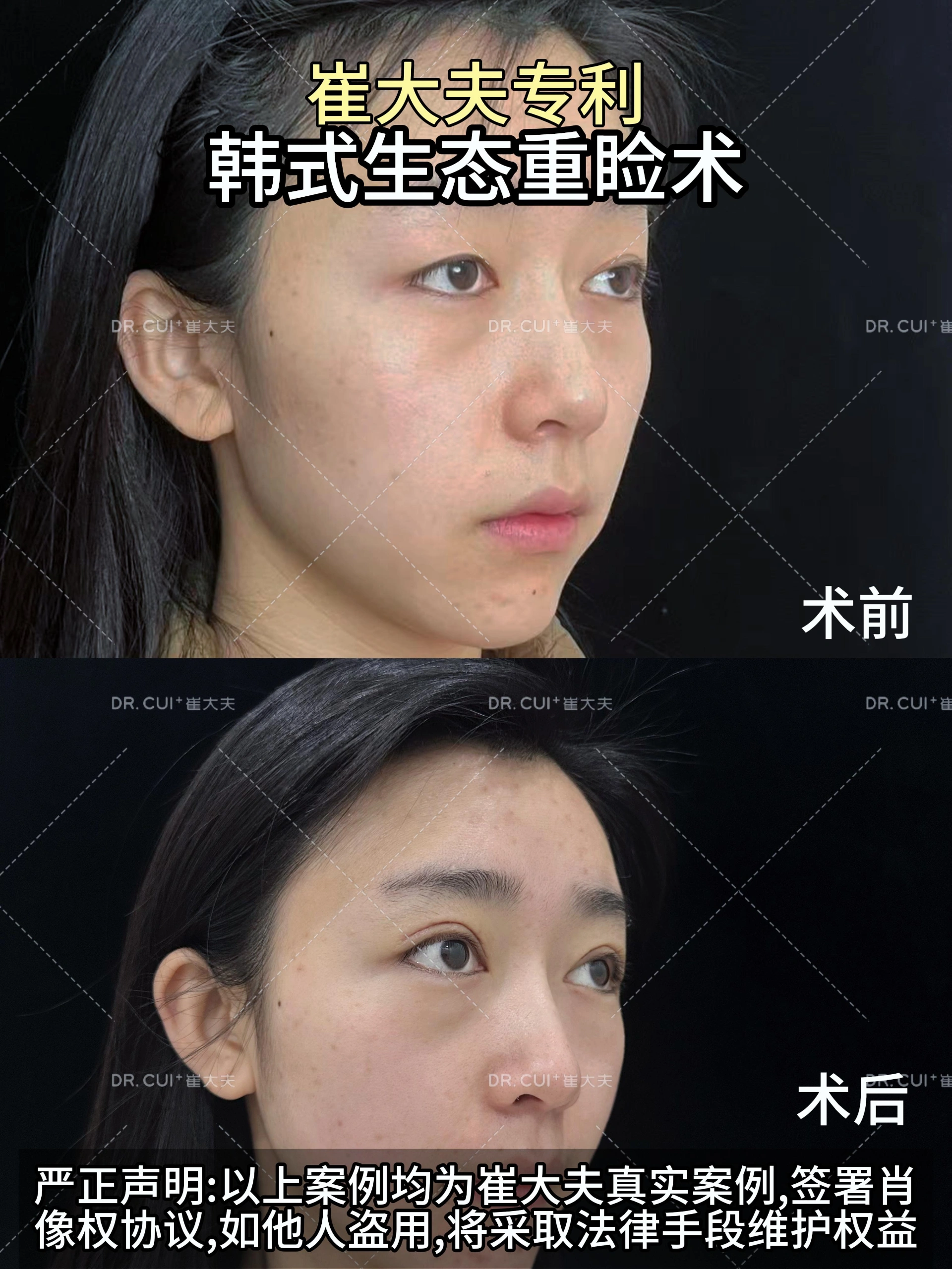 对比 (113)