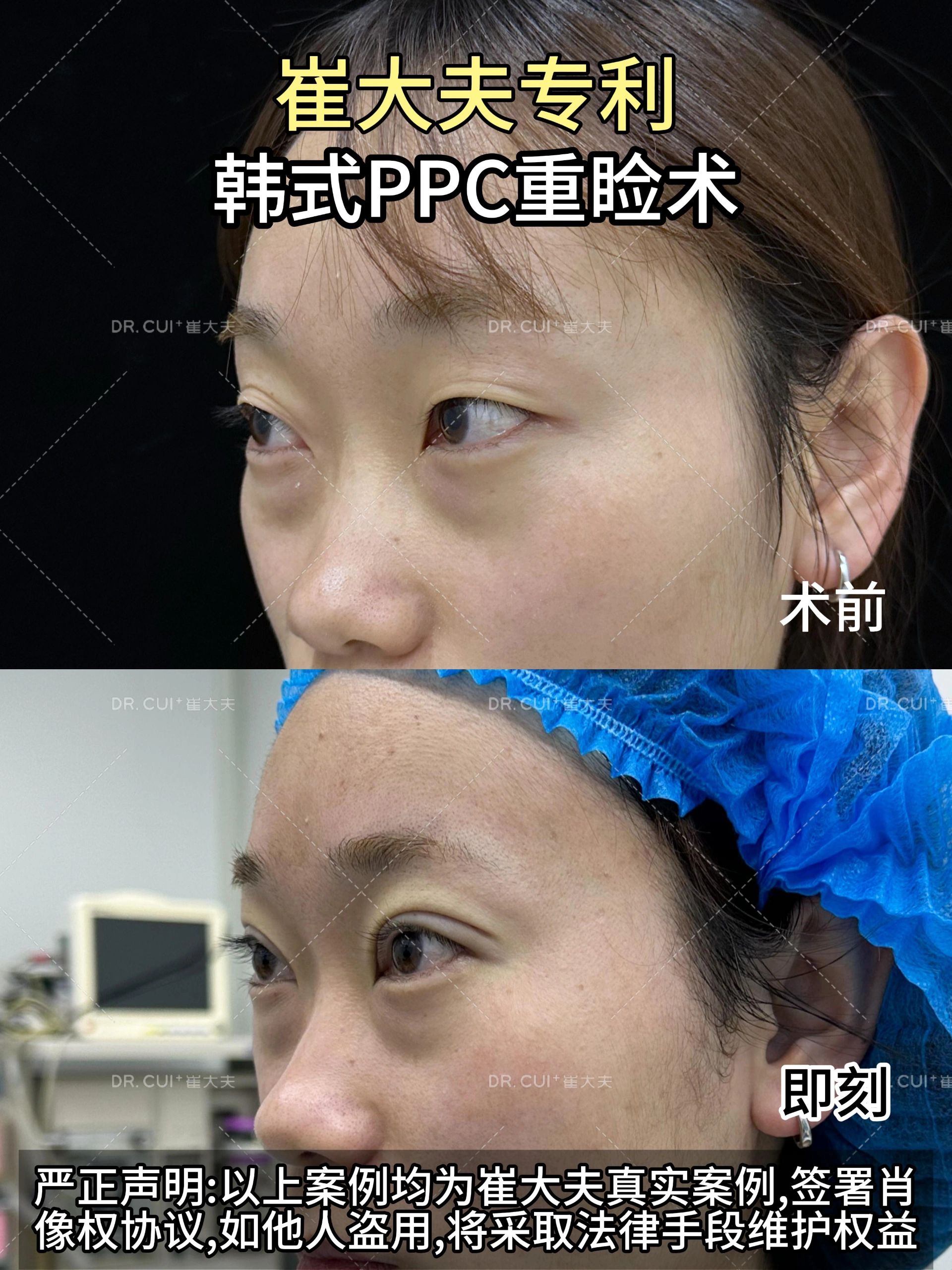 对比 (116)