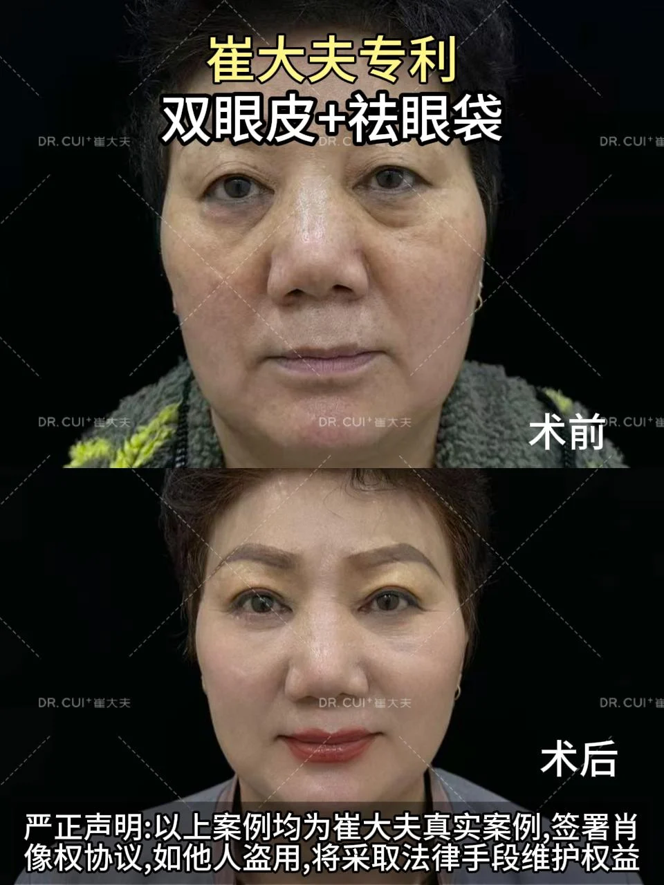 对比 (119)
