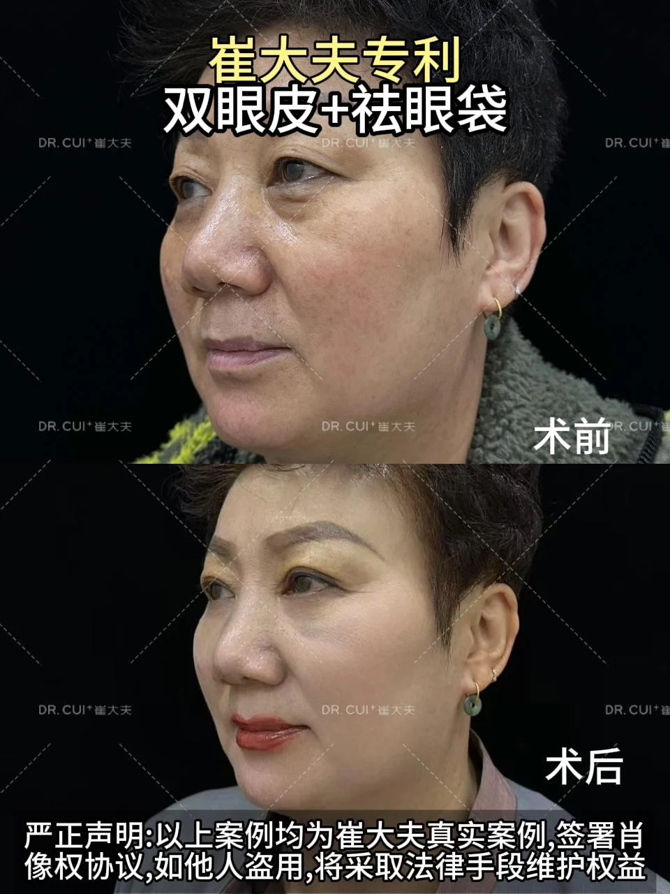 对比 (118)