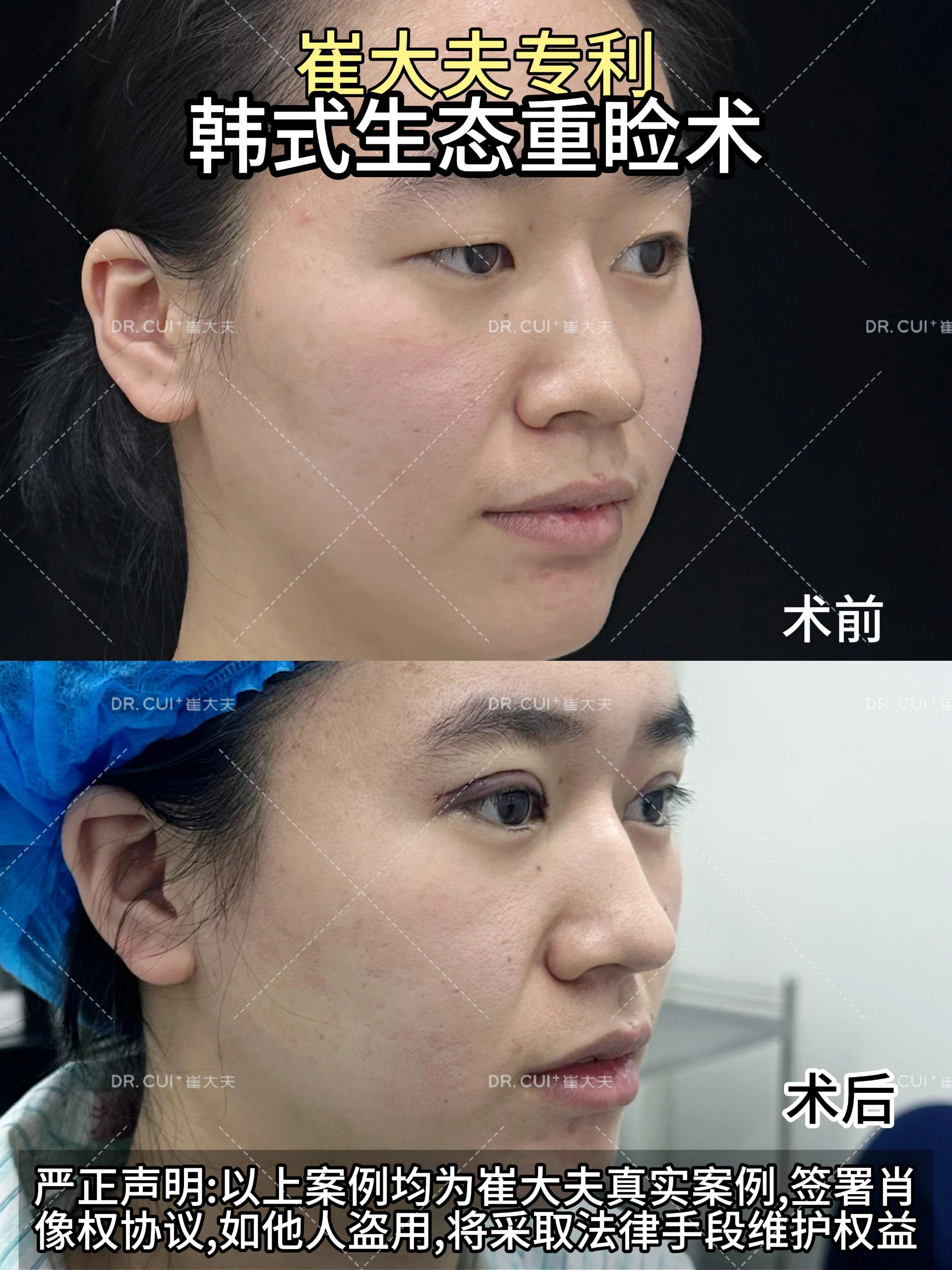 对比 (120)