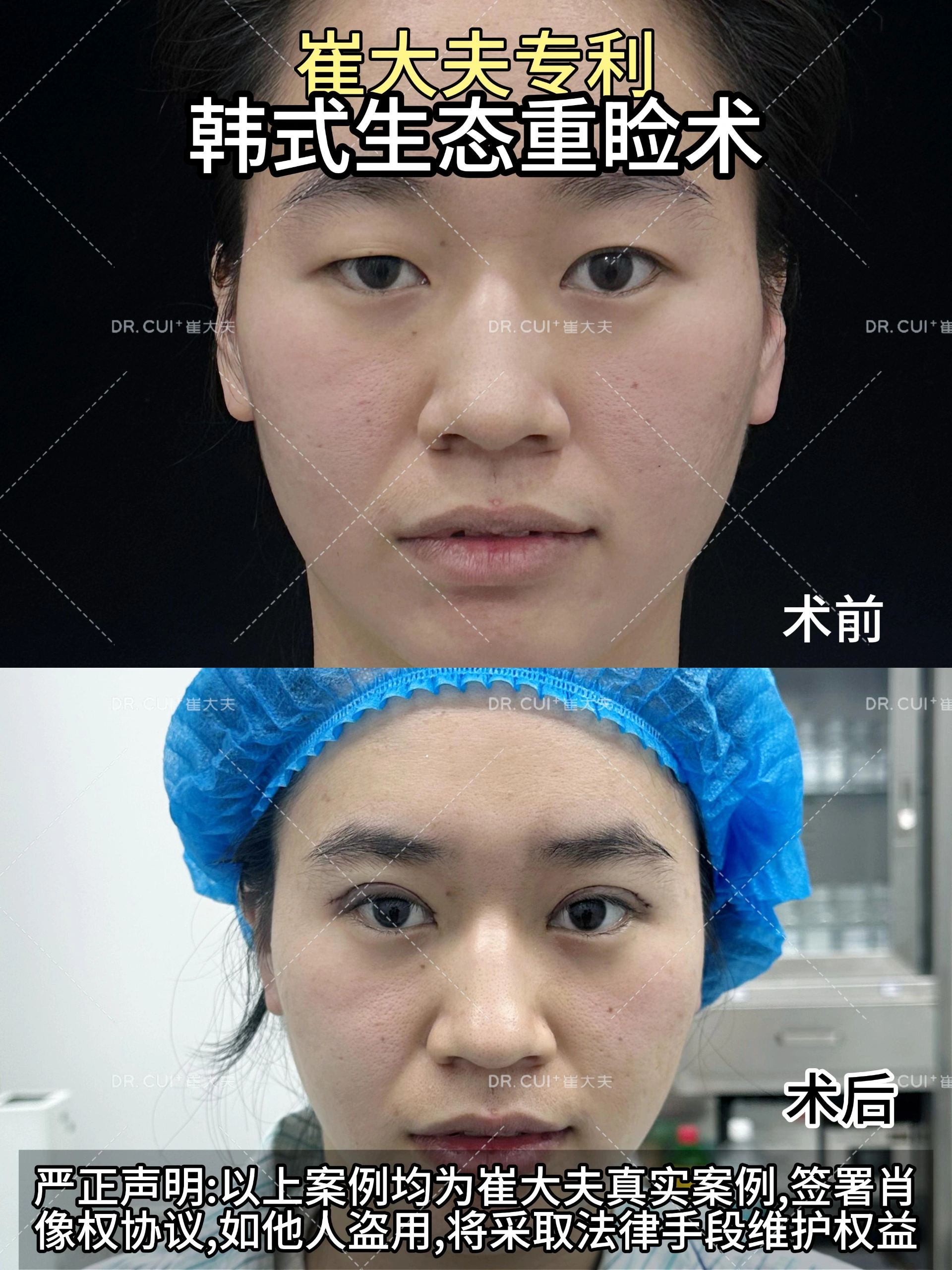 对比 (121)
