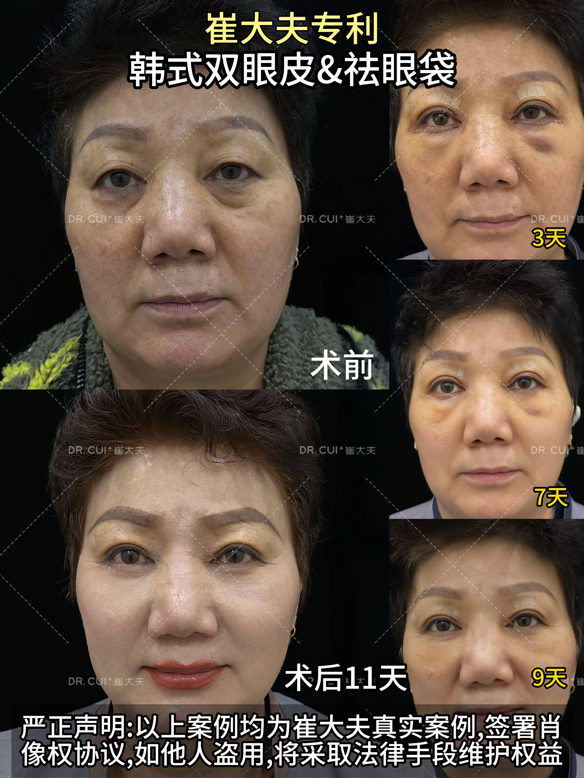 对比 (122)