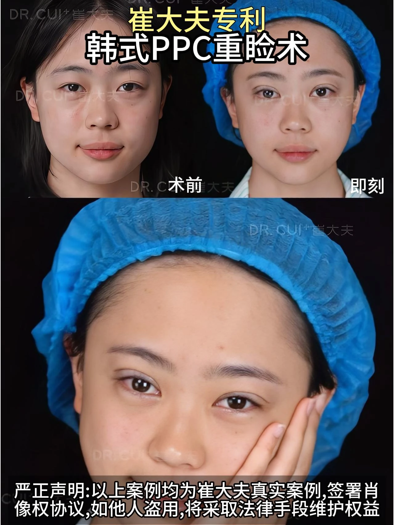 对比 (123)