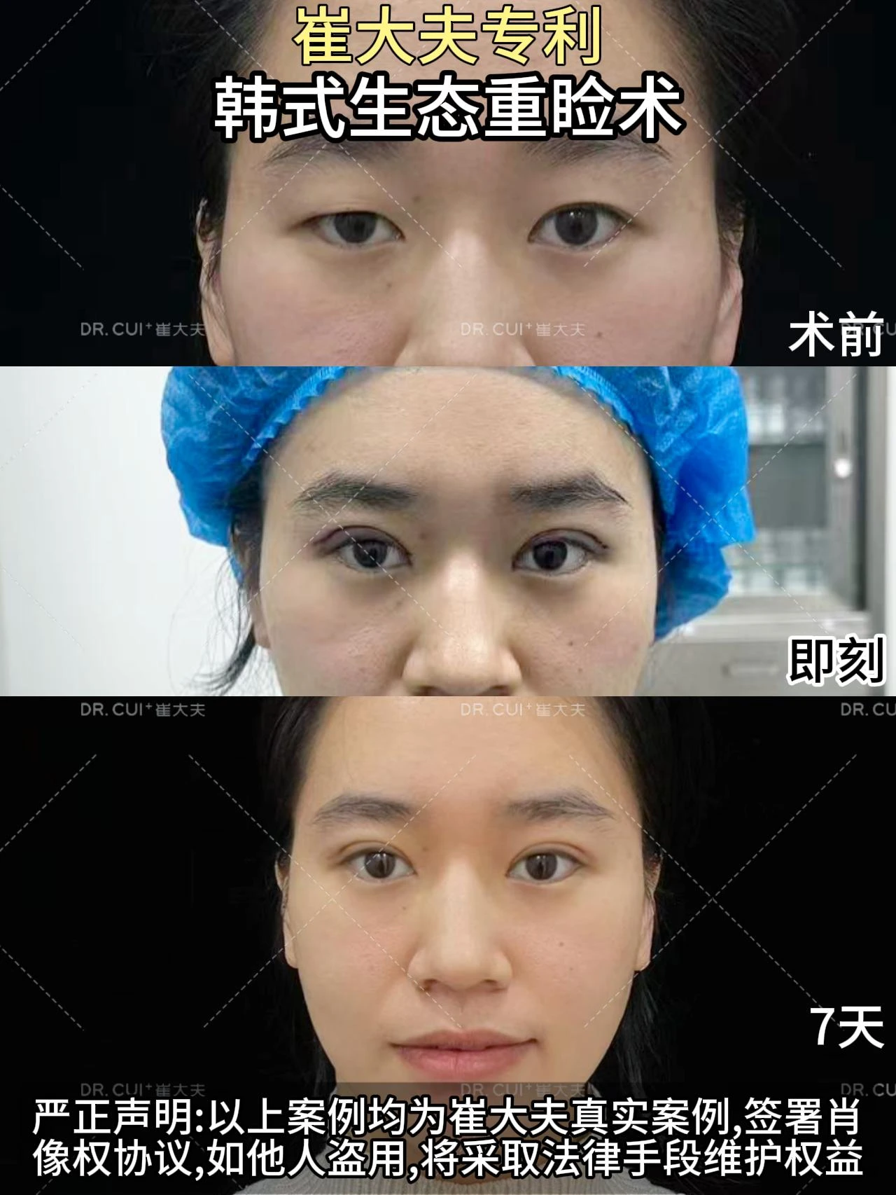 对比 (124)