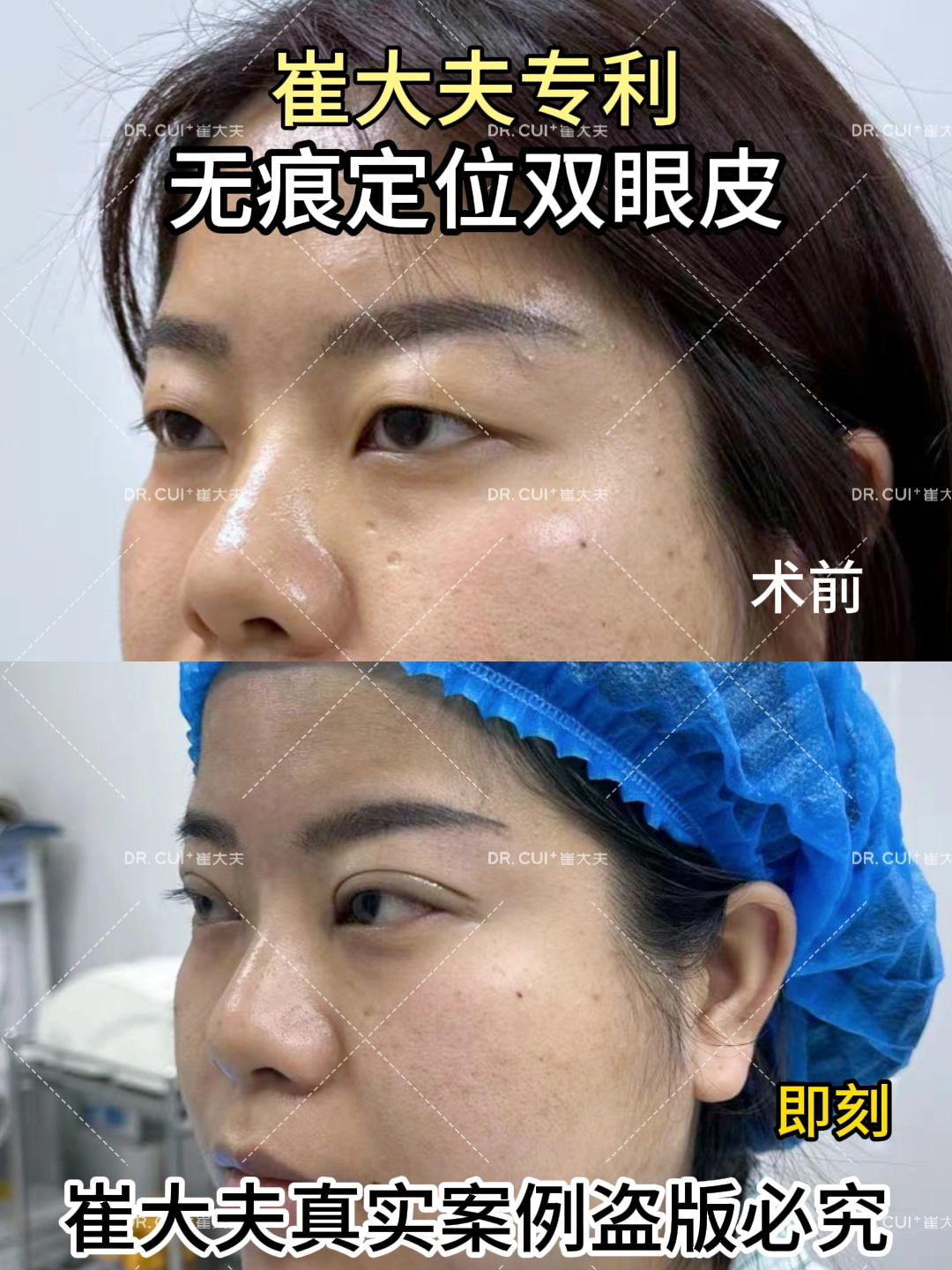对比 (125)