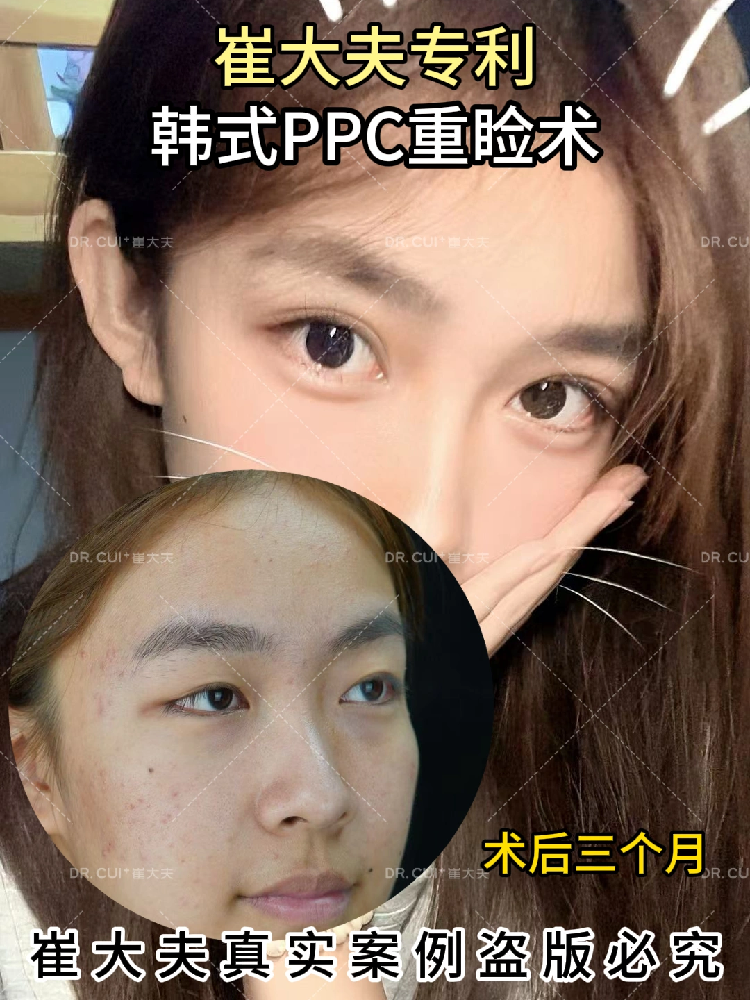 对比 (126)