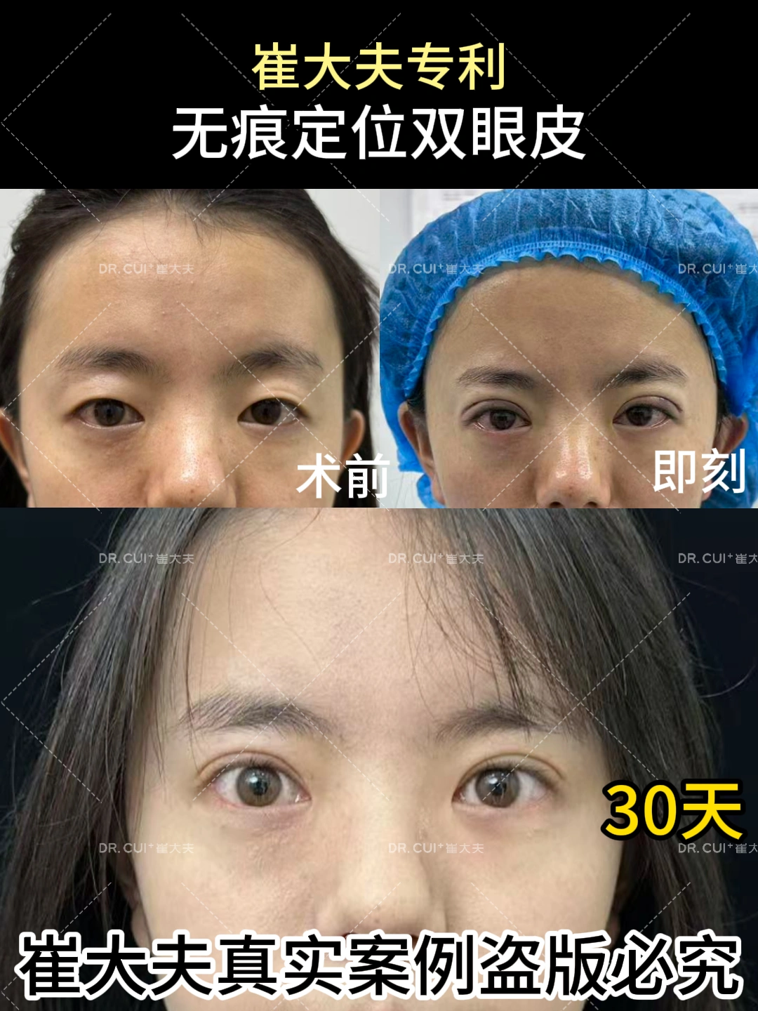 对比 (127)
