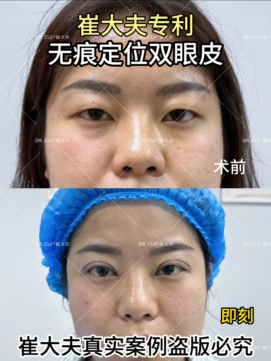 对比 (130)