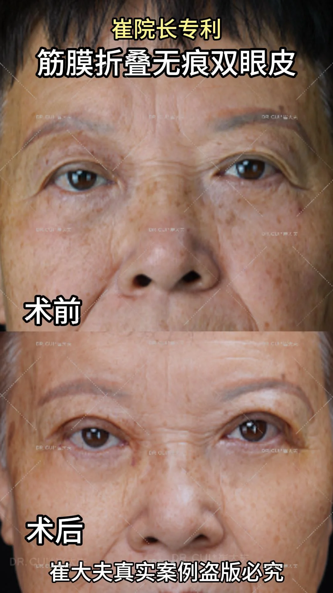 对比 (138)