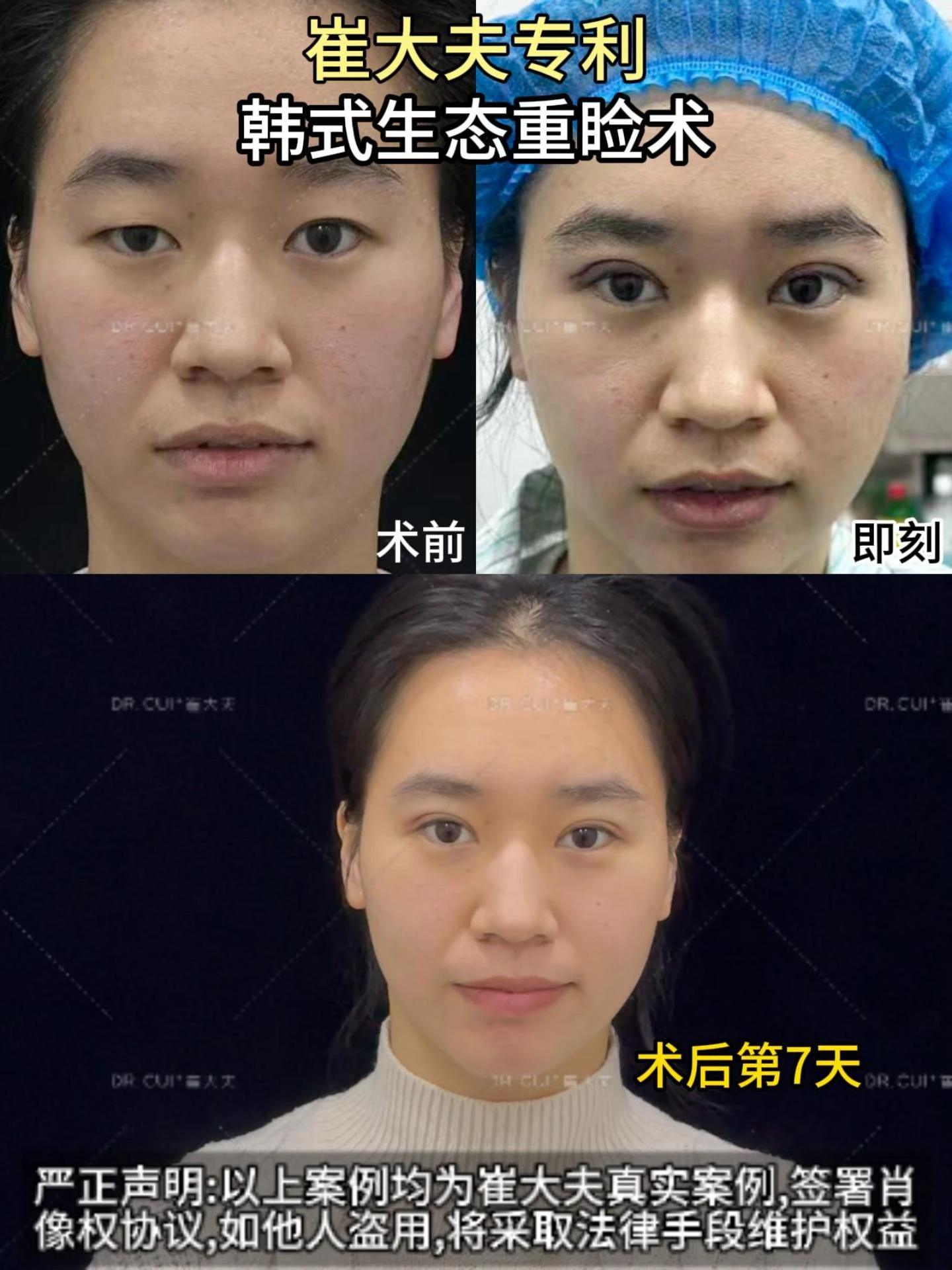 对比 (3)