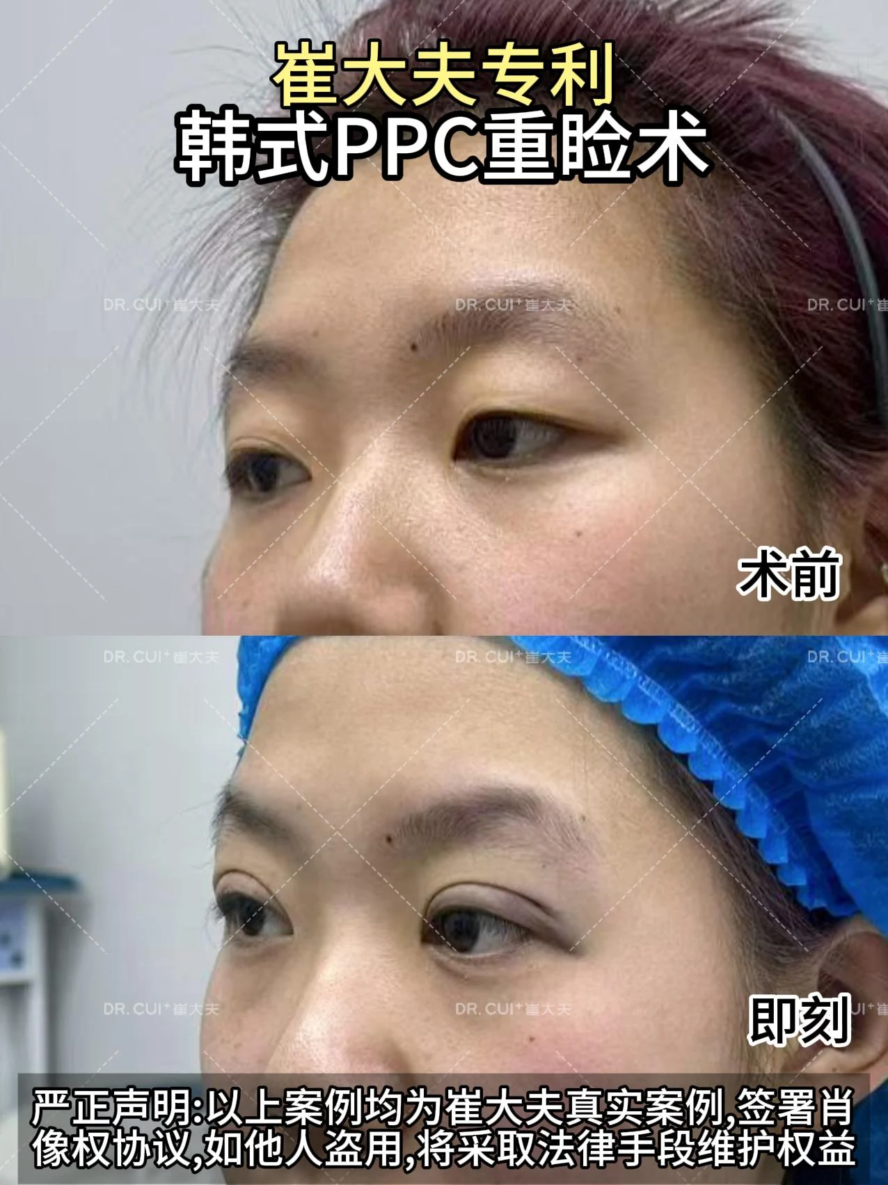 对比 (10)