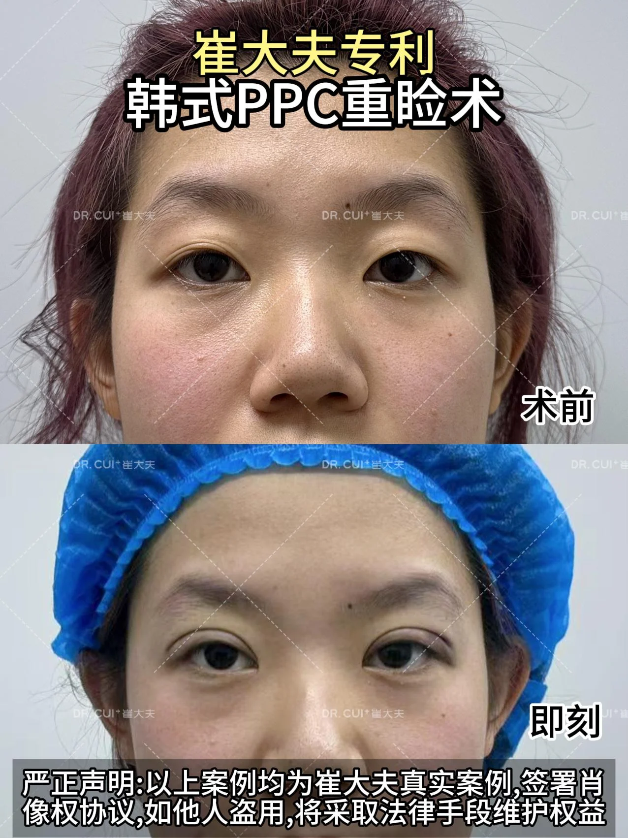 对比 (11)