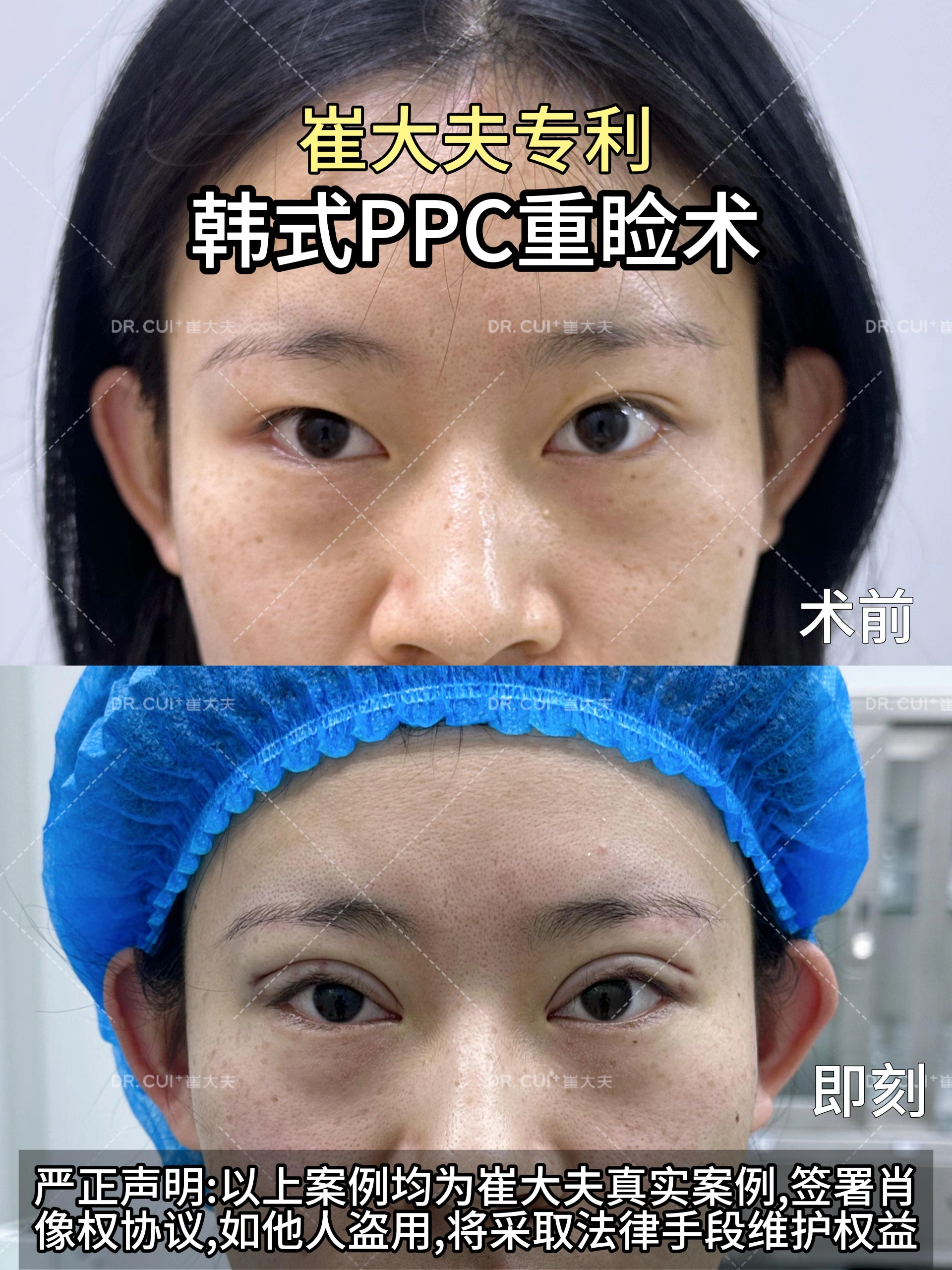 对比 (13)