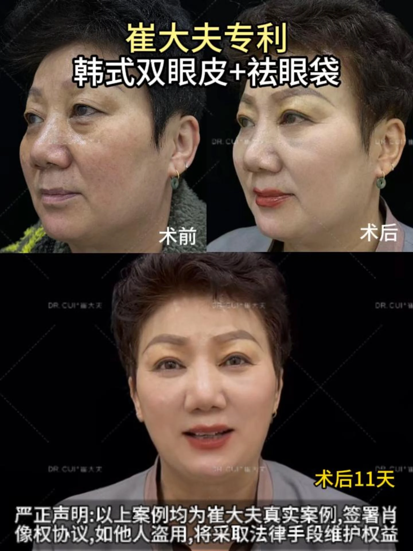 对比 (14)