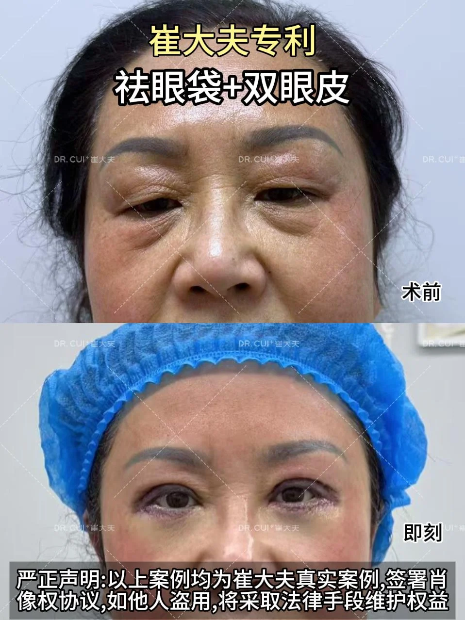 对比 (21)
