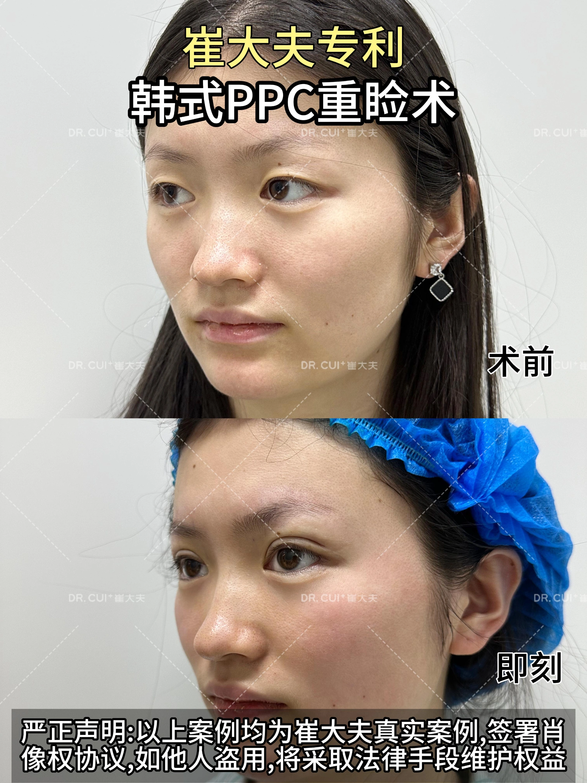 对比 (22)