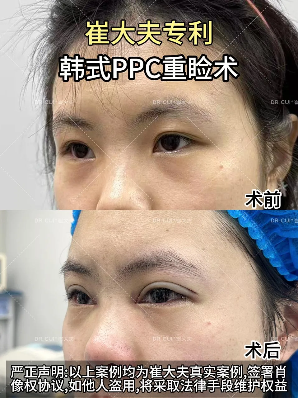 对比 (28)