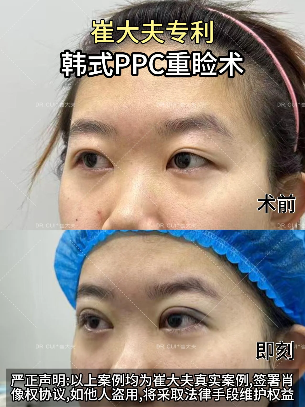 对比 (30)