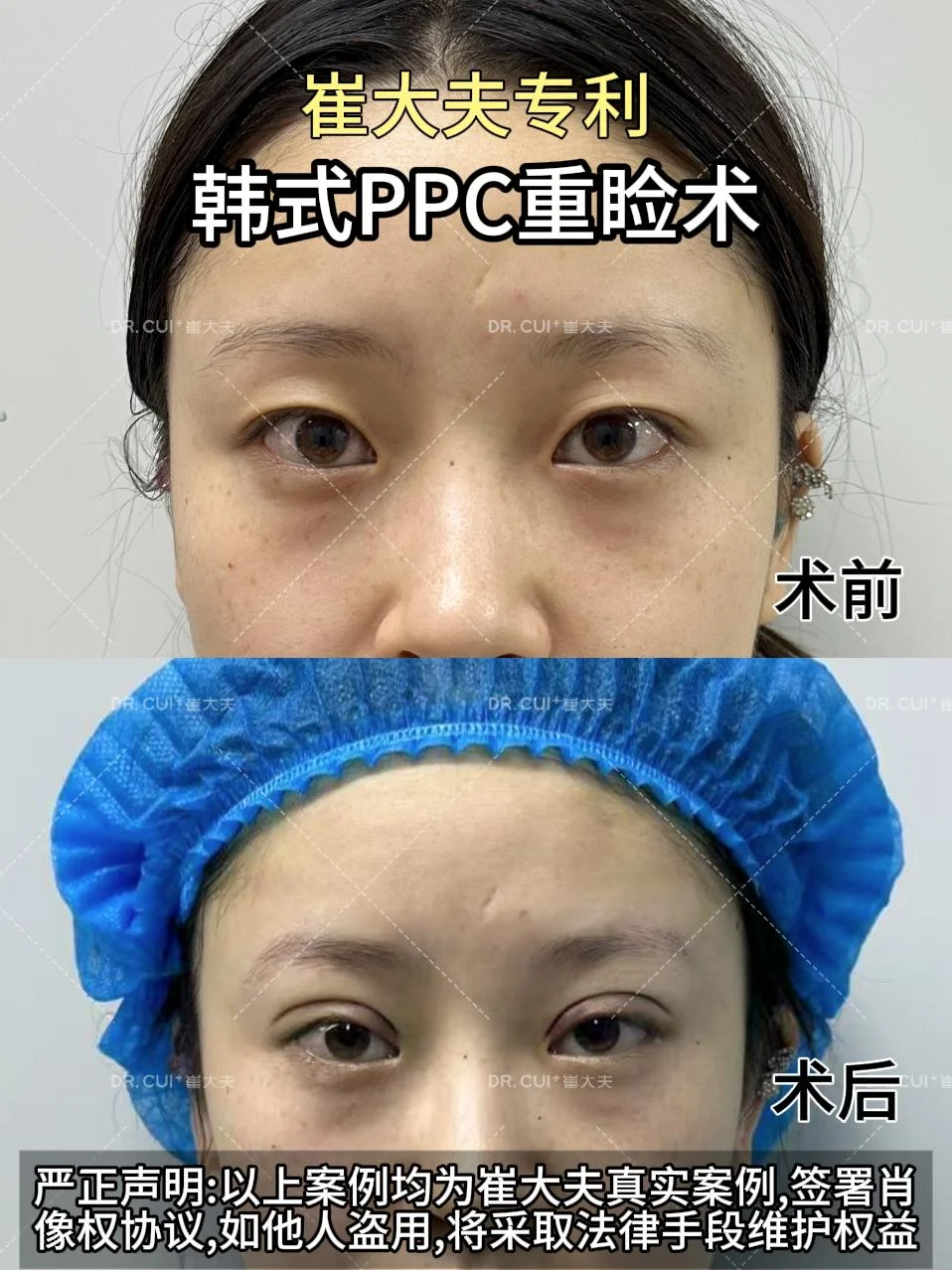 对比 (33)