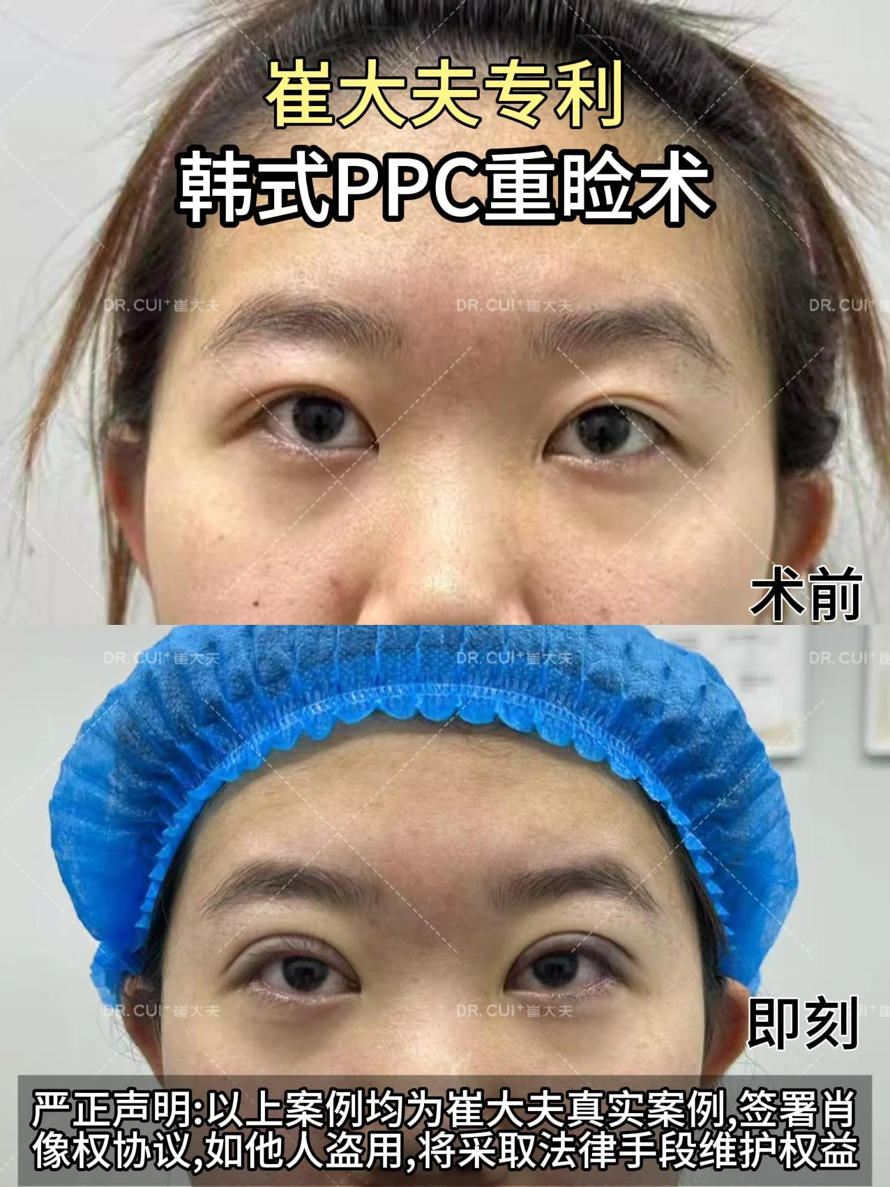 对比 (31)