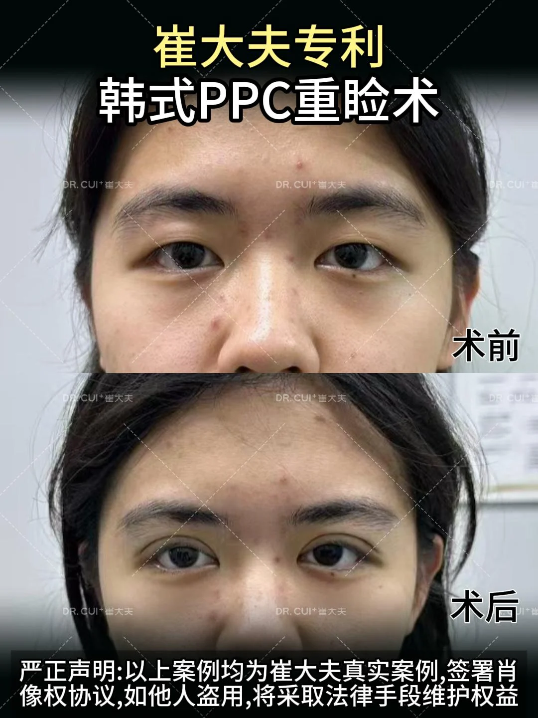 对比 (36)