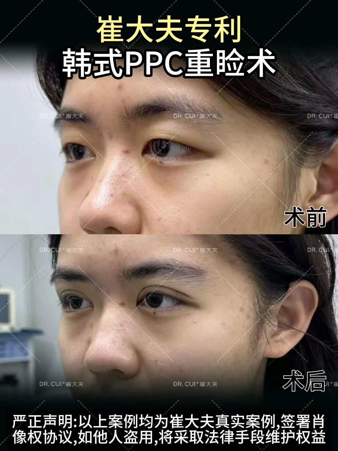 对比 (37)