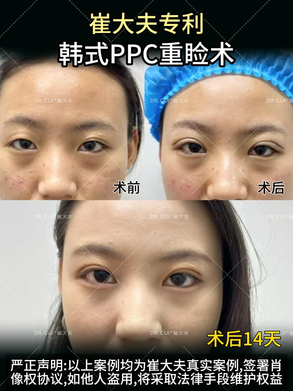 对比 (38)