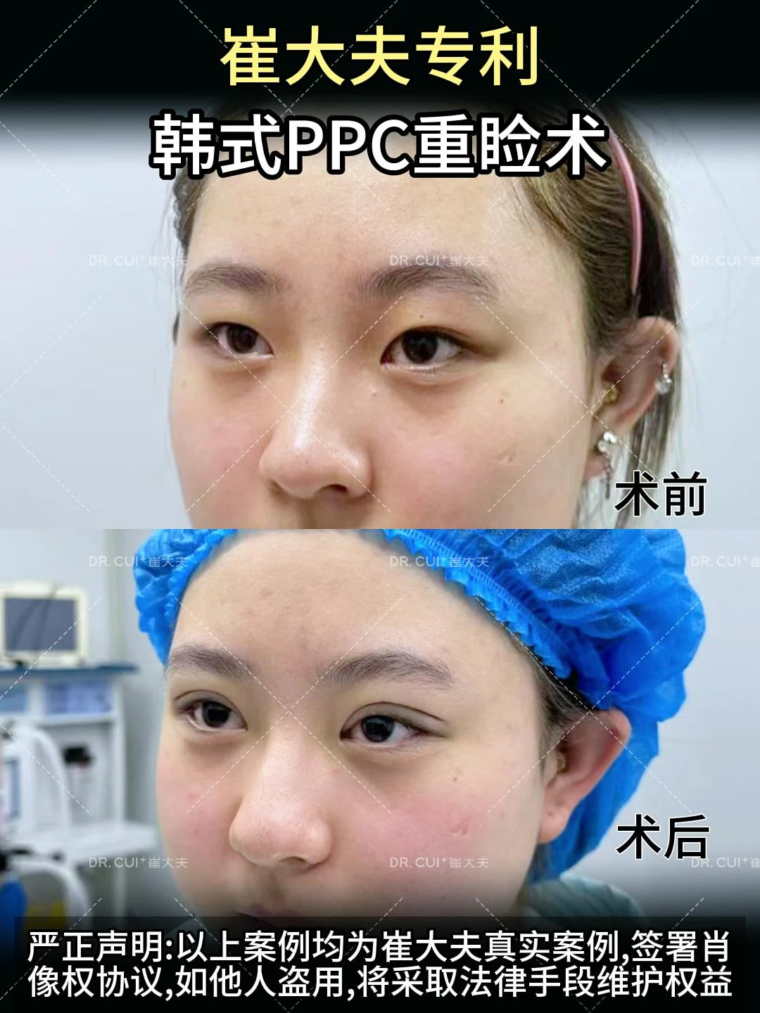 对比 (42)
