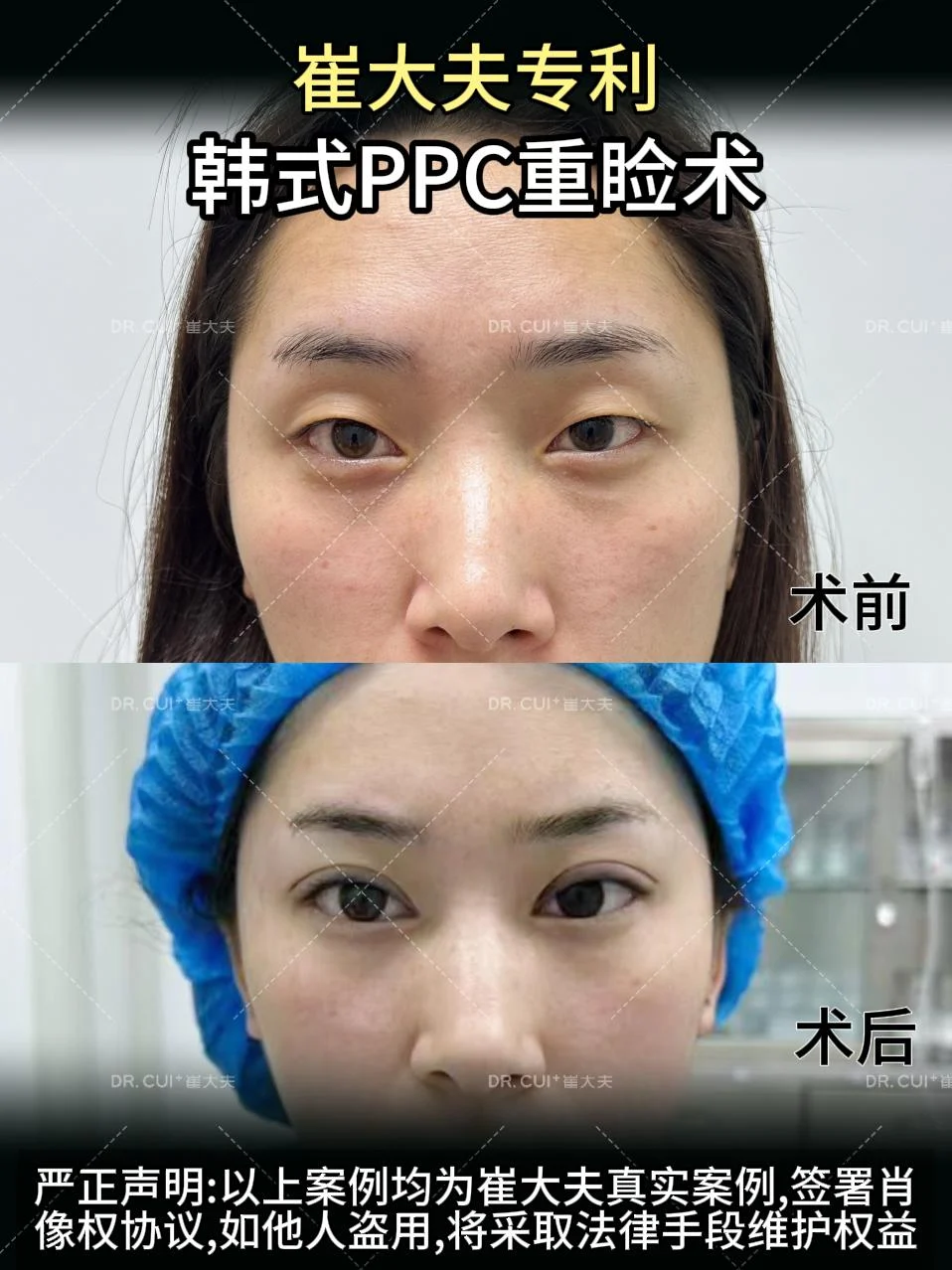 对比 (46)