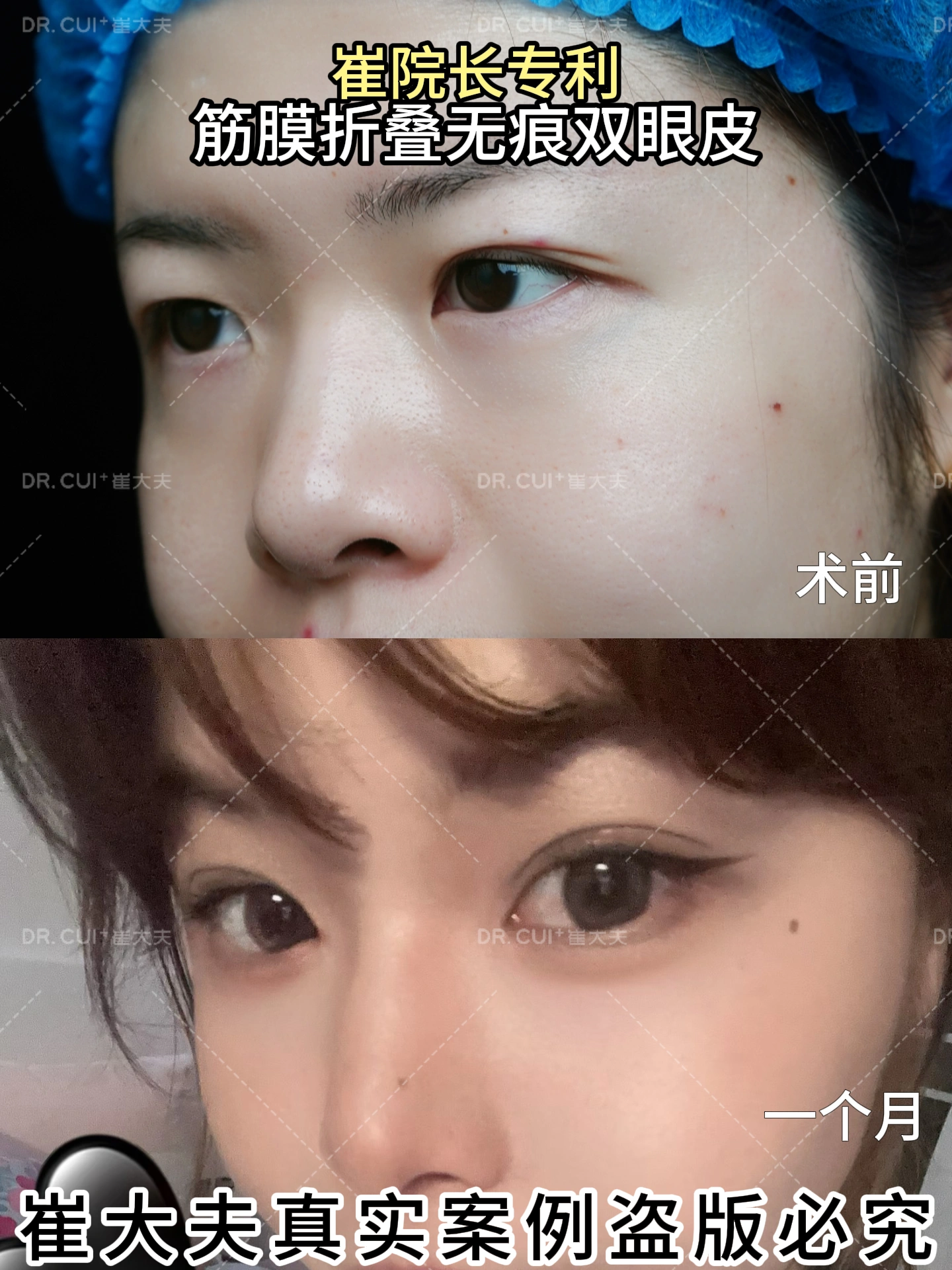 对比 (51)
