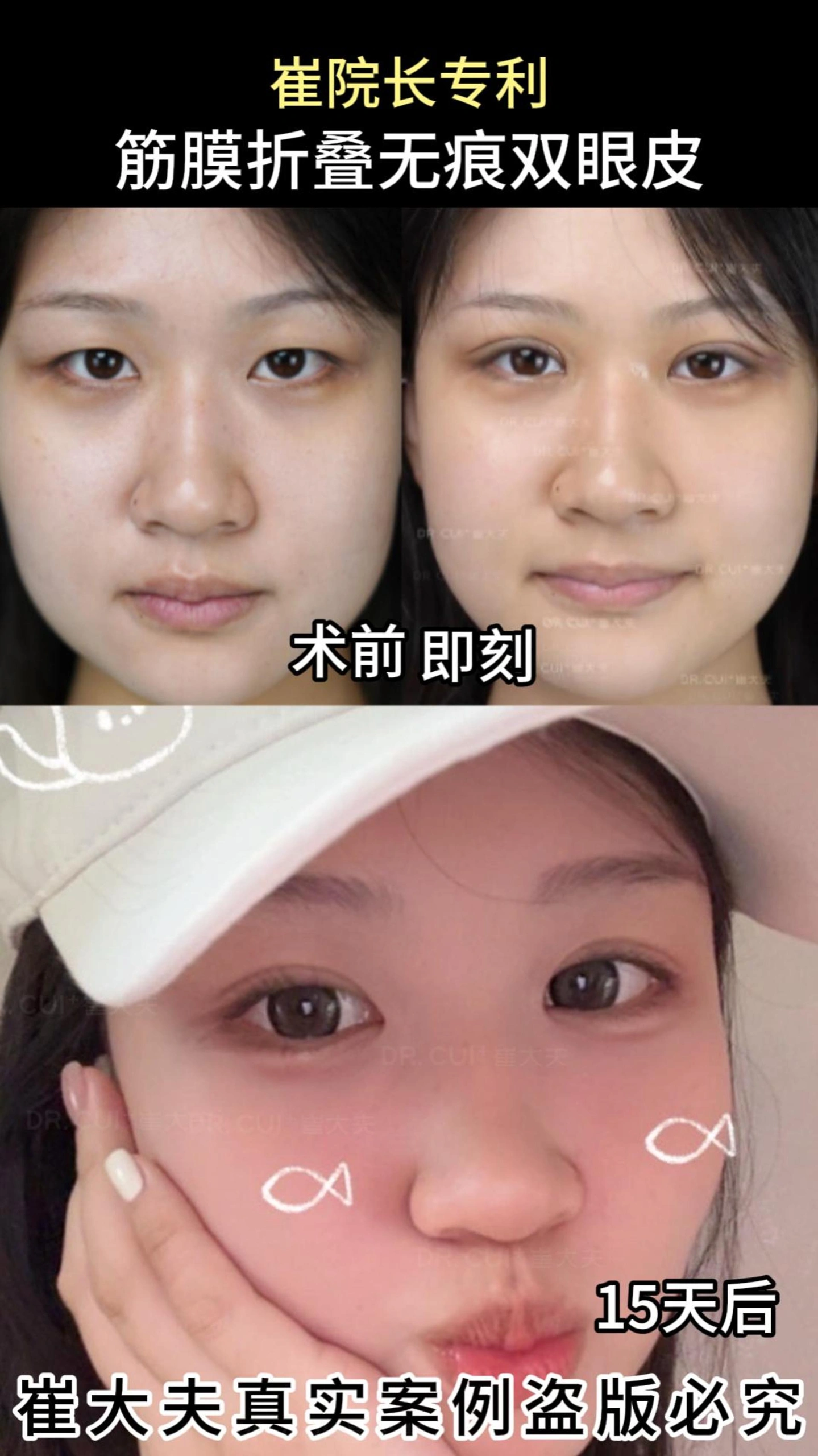 对比 (50)