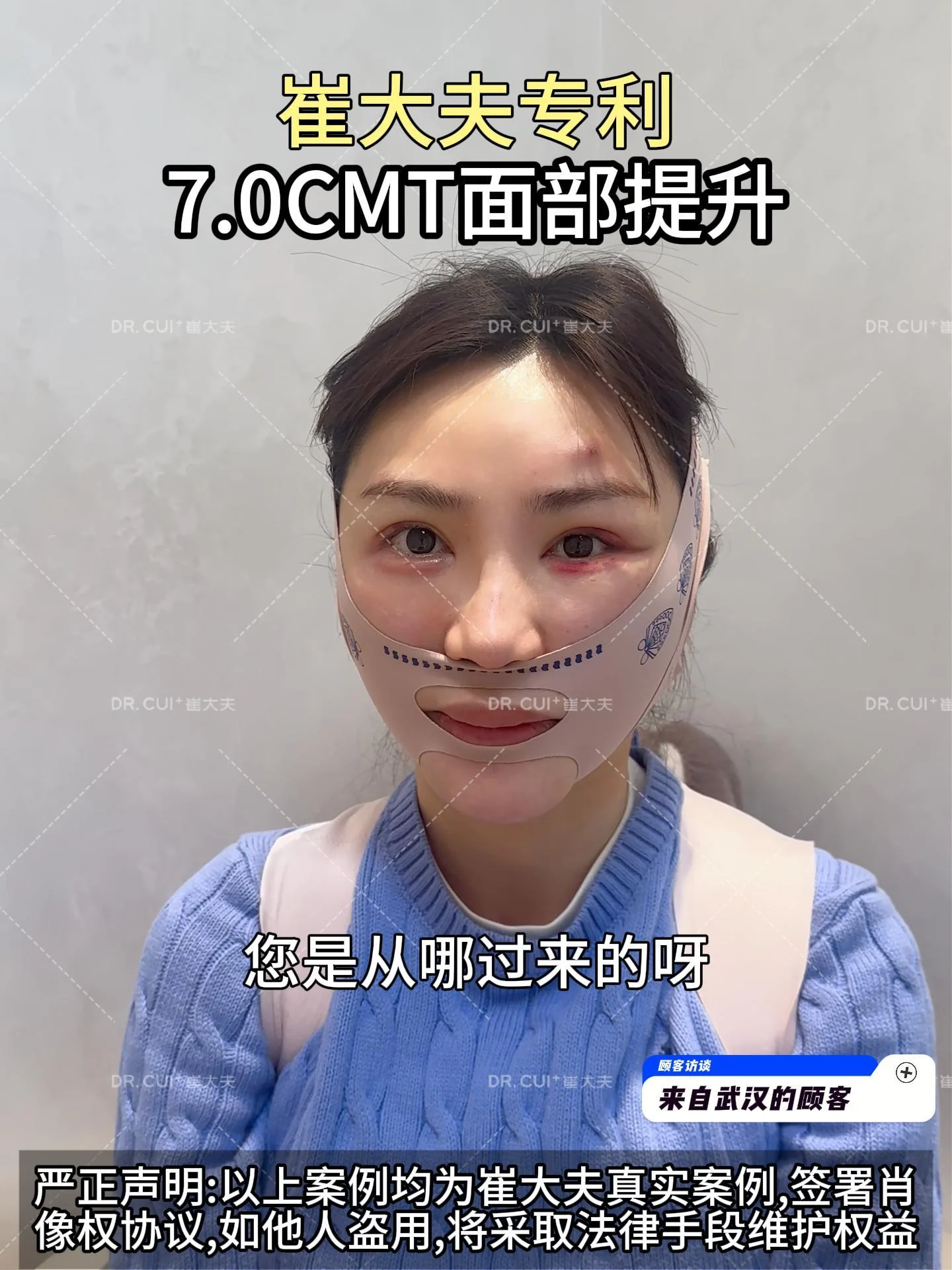 1月2日 (2)——武汉姐姐采访-封面