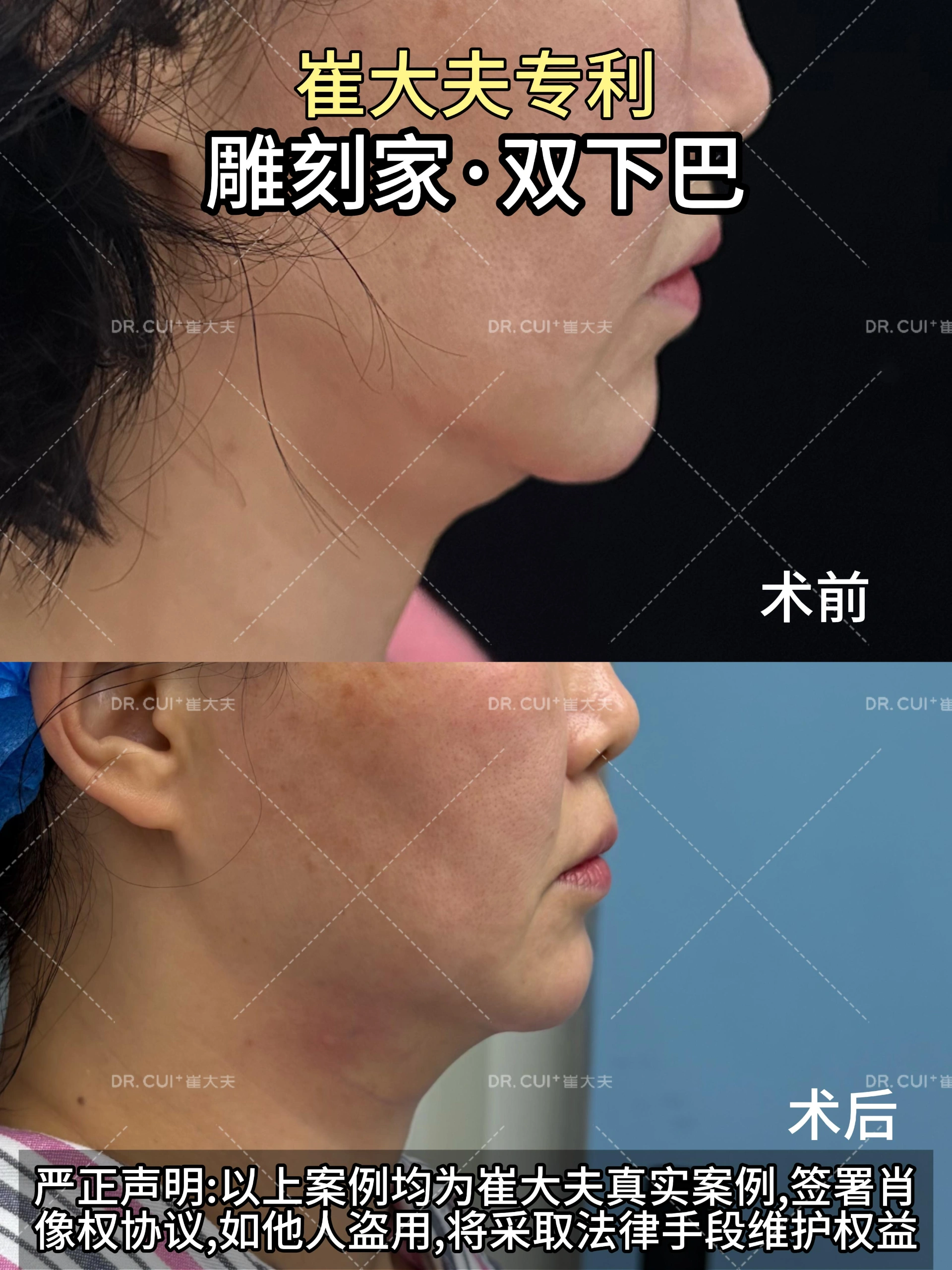 1月10日(1)雕刻家