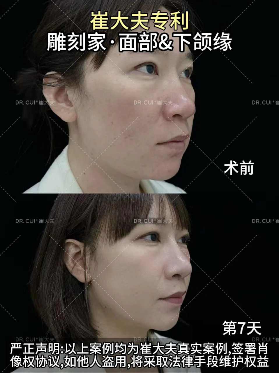 12月18日颜卫莉雕刻家45°图