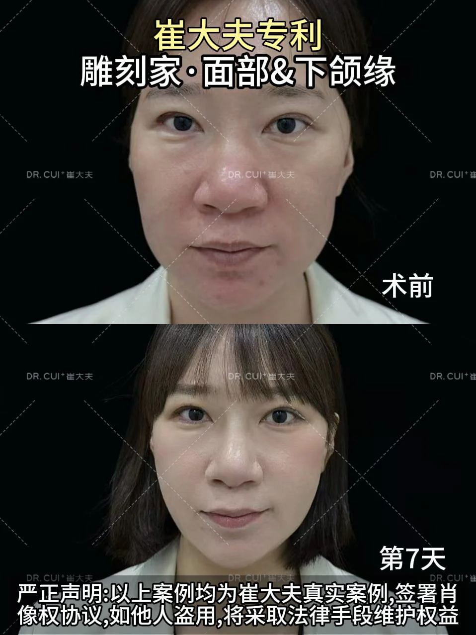 12月18日颜卫莉雕刻家正面图