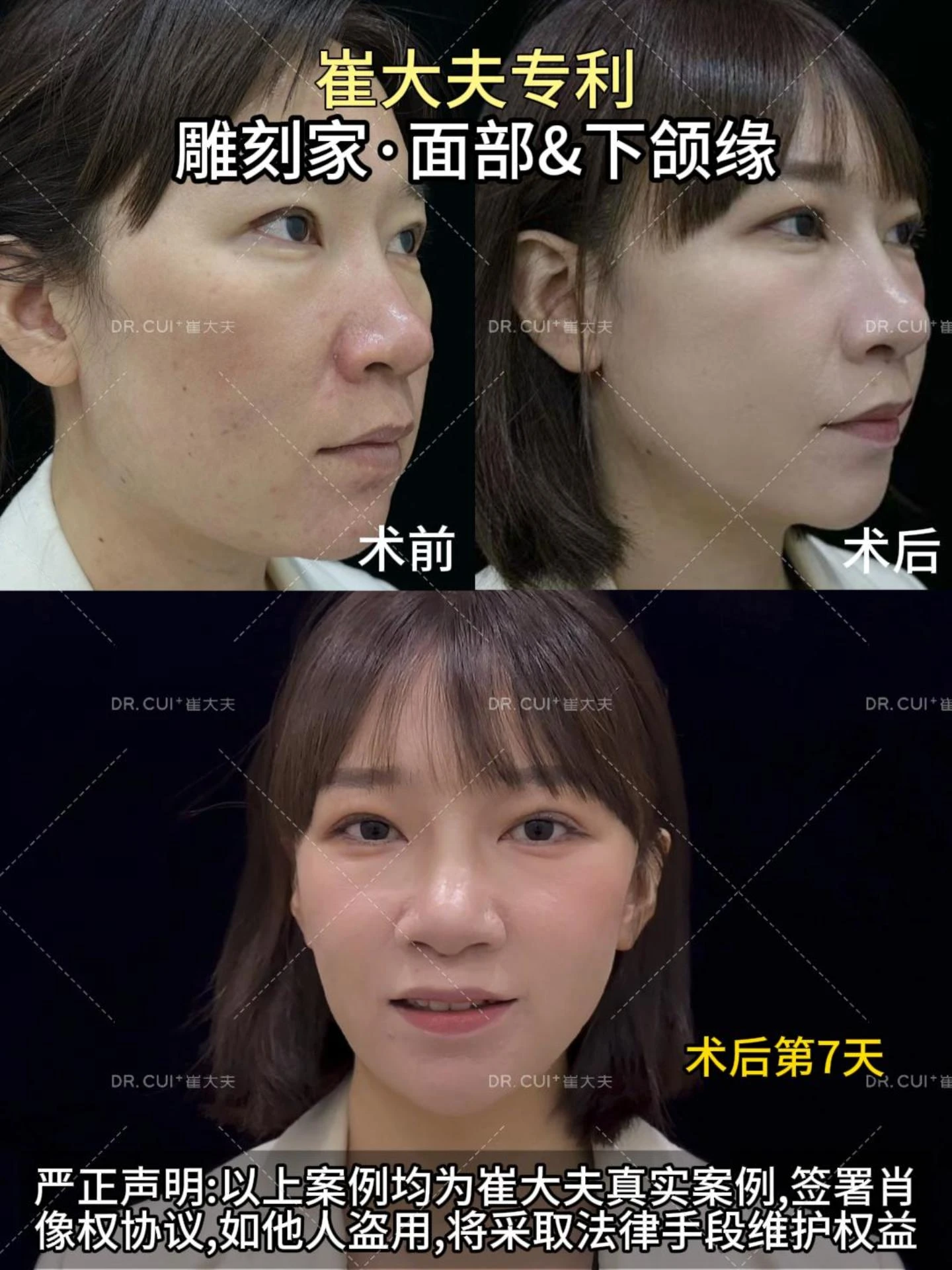 颜卫莉雕刻家中下面部封面图12月18日