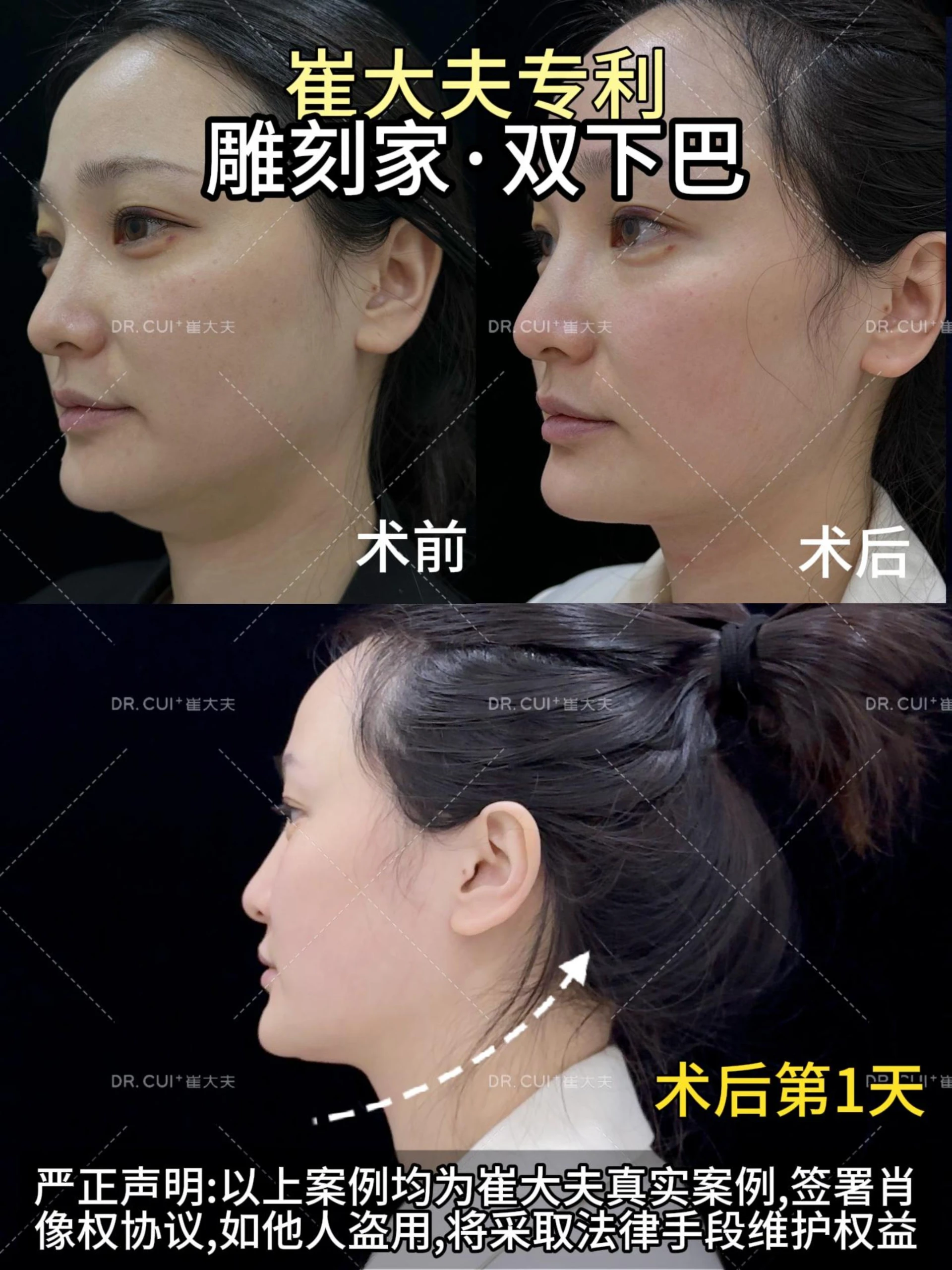 张艳龙雕刻家双下巴封面图