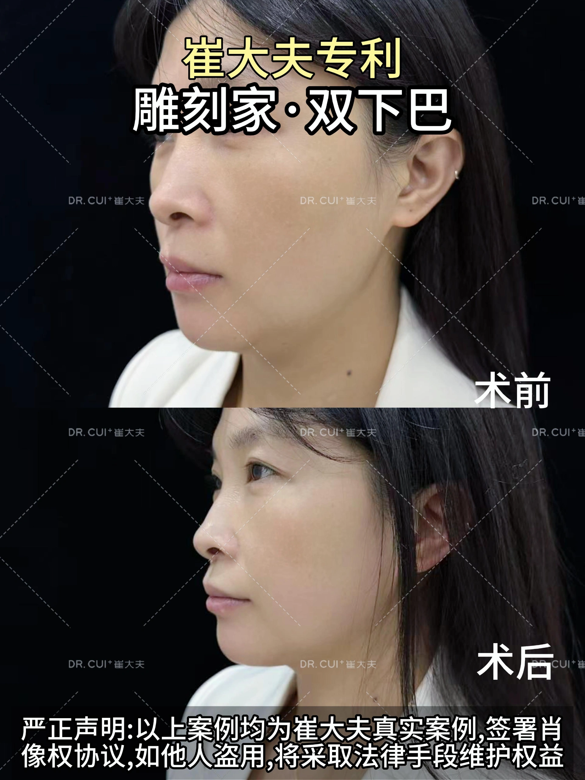 12月13日 (1)雕刻家2