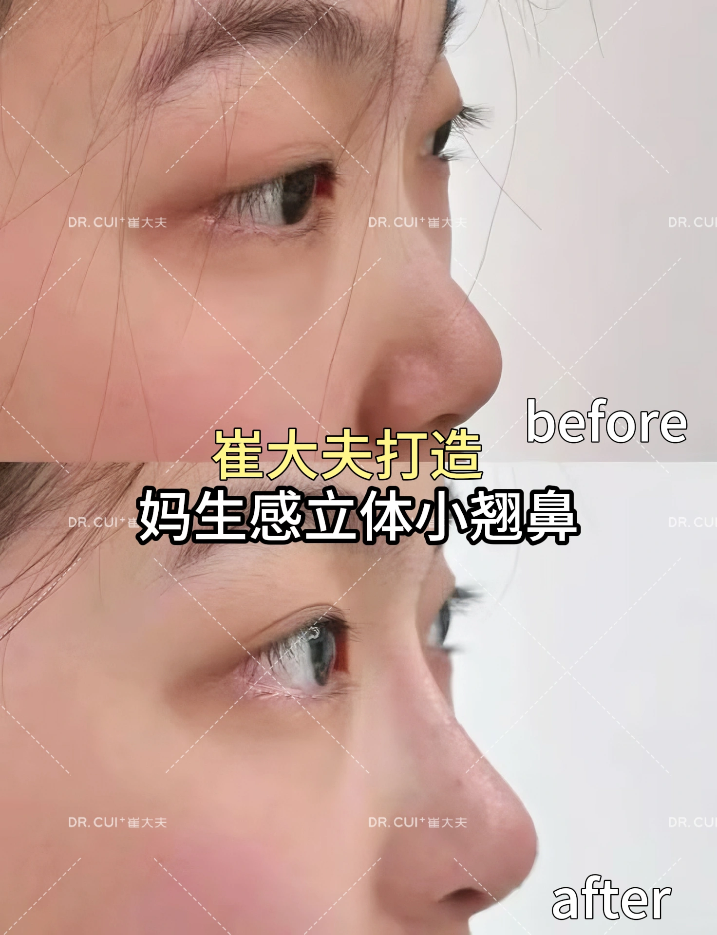案例3