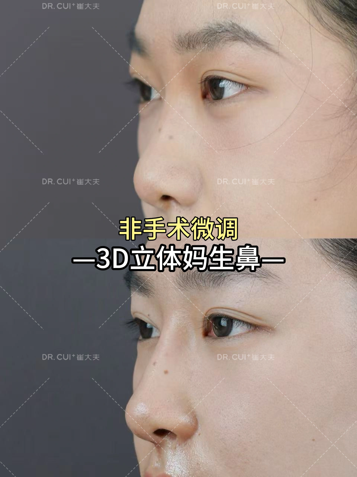 案例5
