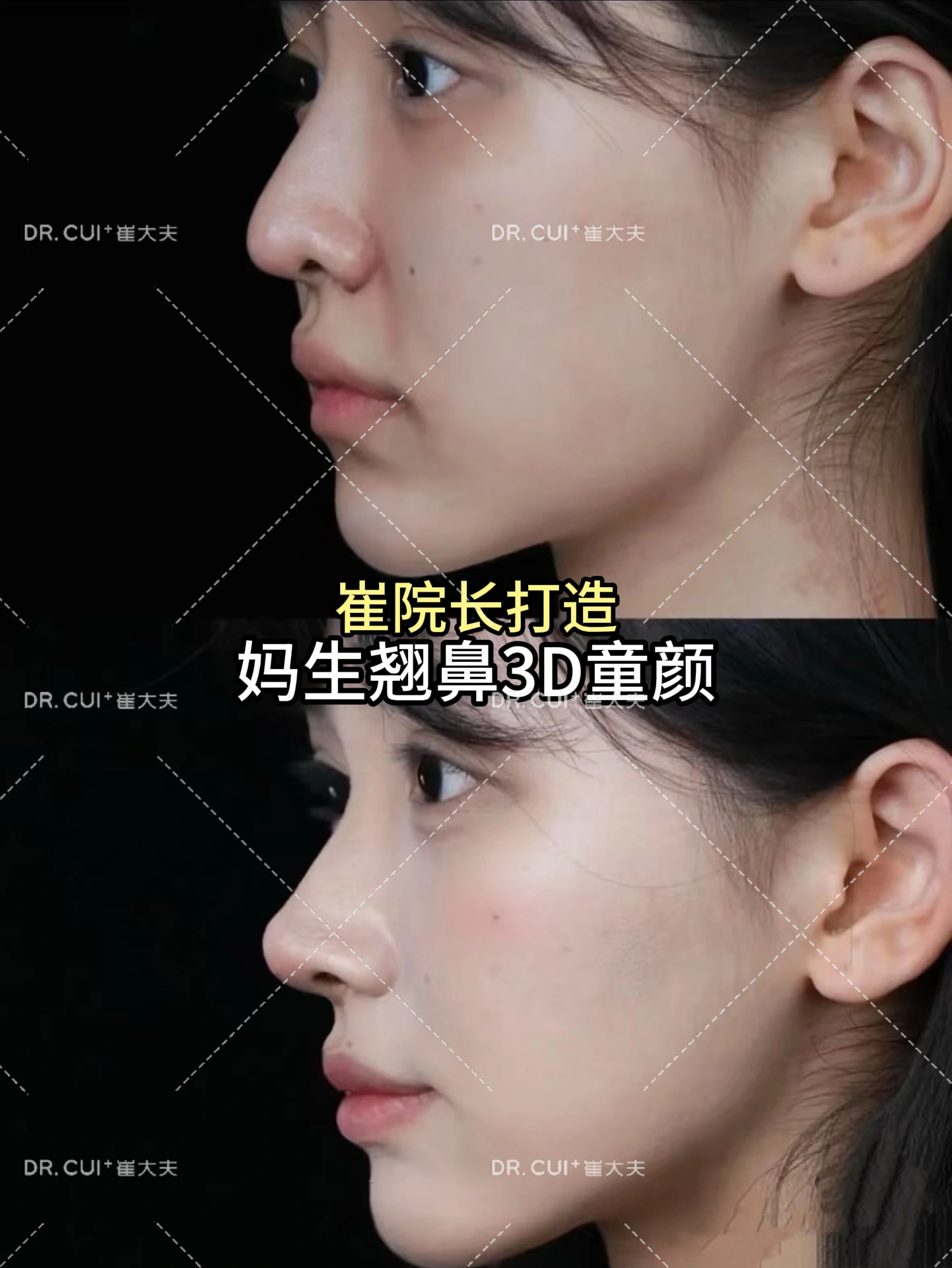 案例8