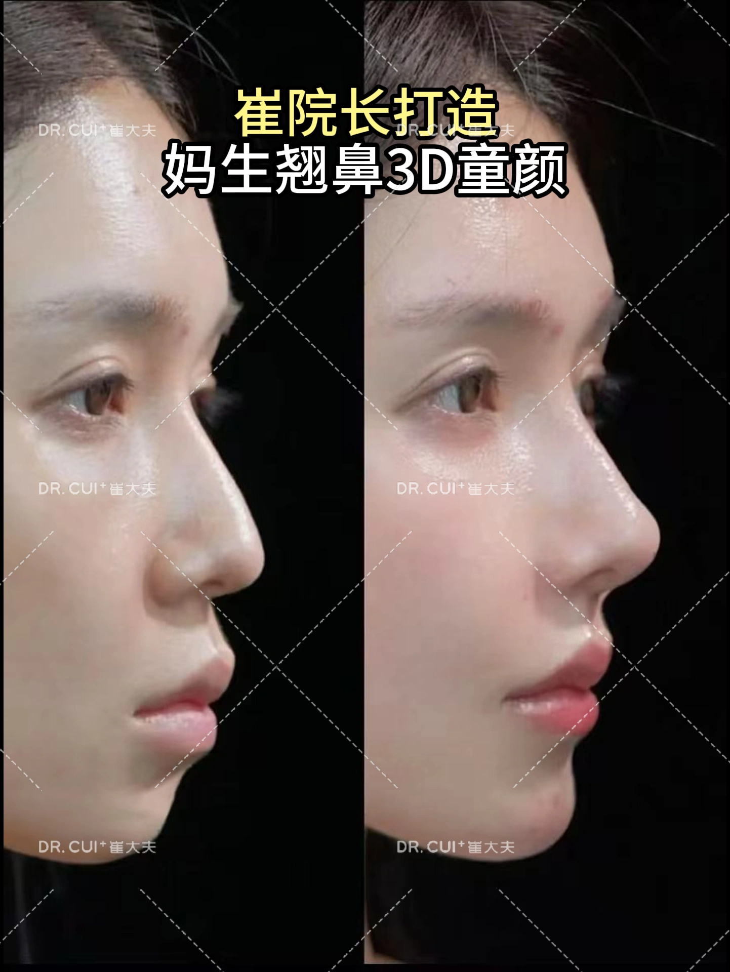 案例9